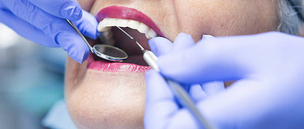 Best Emergency Dentist for Knocked-Out Tooth in Bethlehem Village, CT